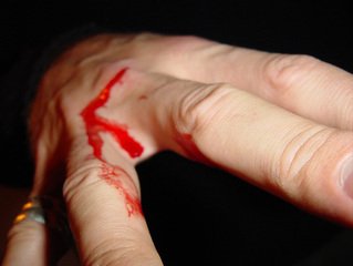 bloody-hand-1254272.jpg
